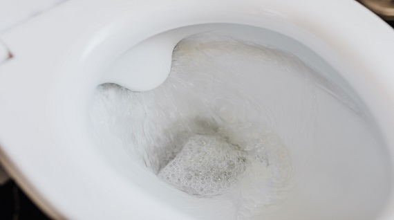 how to get rid of yellow stains in the toilet